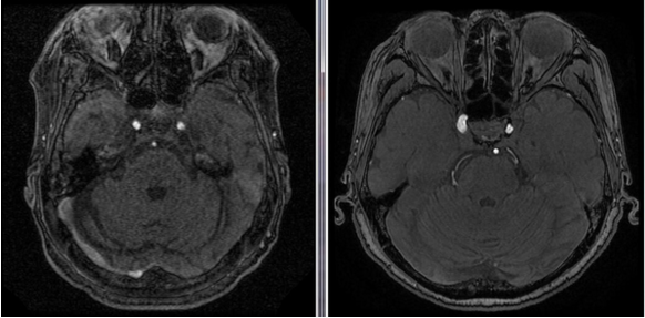 北京华坛中西医结合医院引入全球最新3.0T核磁共振